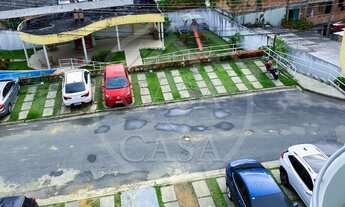 Imagem 2: Apartamento André Araújo