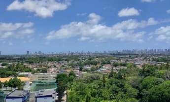 Imagem 2: JS) Lindo apartamento de 03 quartos no Barro - José Rufino - Edf. Alameda Park