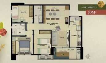 Imagem 5: NI - Apartamento I 2 e 3 Quartos I Na Caxangá I Altíssimo Padrão