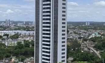 Imagem 3: DU) Pronto pra morar | Conheça o incrível Hilson Macedo