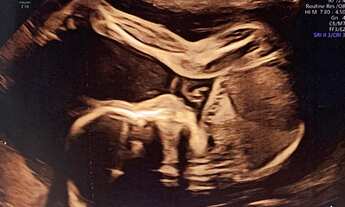 Imagem 6: Ótimo Apto com suíte e salas comerciais em mangabeira