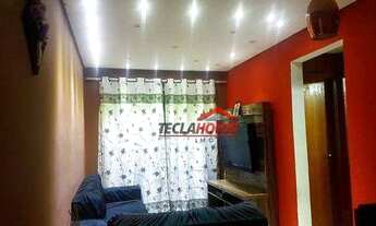 Imagem 2: APARTAMENTO TODO PLANEJADO E MOBILIADO (VISTA LIVRE