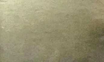 Imagem 3: Apartamento de Alto Padrão à Venda 3 Suítes, 155m², Andar Alto, Completo em Armários e La