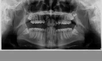 Imagem 3: Casa na cidade de bacabeira