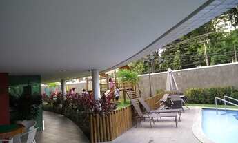 Imagem 3: Jean Charles / Rosarinho: Alto padrão, localização privilegiada, lazer completo, 4 suítes