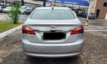 Imagem 3: HB20S - 2015 Quarto com aluguel por R$35.000 /mês