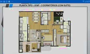 Imagem 3: Campo Grande - Aptos 2 dorm com terraço suite e vaga a 458 mil