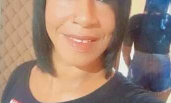 Imagem 2: Cabelo humano megarre