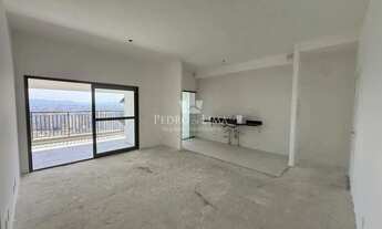 Imagem 4: Condomínio Parque Diálogo Padre Adelino, 3 quartos suítes 4 banheiros 2 vagas de garagem n