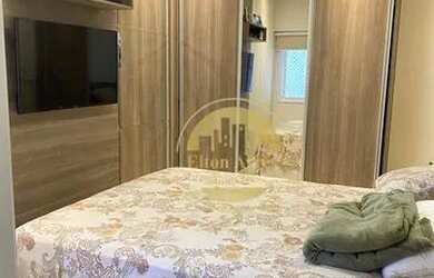 Imagem 13: 3 dormitórios com 3 suítes no Gonzaga, lazer completo