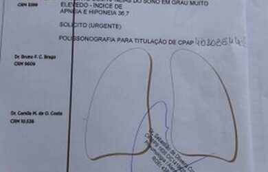 Imagem: A casa em condomínio possui 2 Dormitórios, 1 Banheiro, 2 Vagas